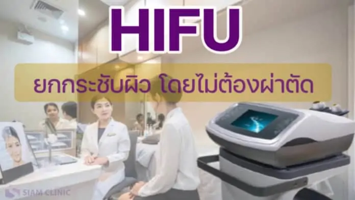 HIFU