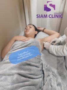 Botox armpit injection